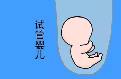 取卵手术室